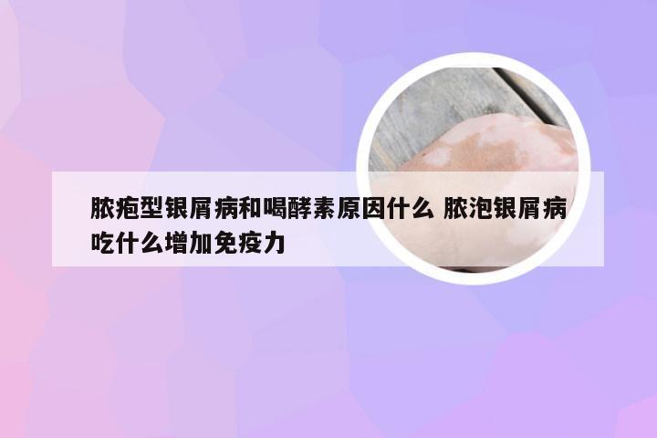脓疱型银屑病和喝酵素原因什么 脓泡银屑病吃什么增加免疫力