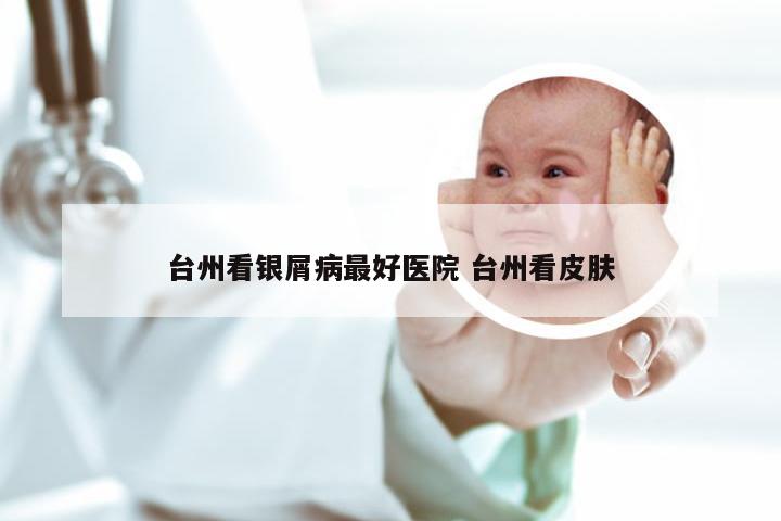 台州看银屑病最好医院 台州看皮肤
