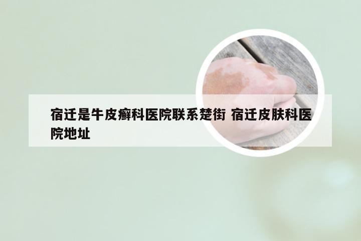 宿迁是牛皮癣科医院联系楚街 宿迁皮肤科医院地址