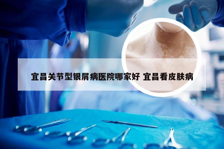 宜昌关节型银屑病医院哪家好 宜昌看皮肤病