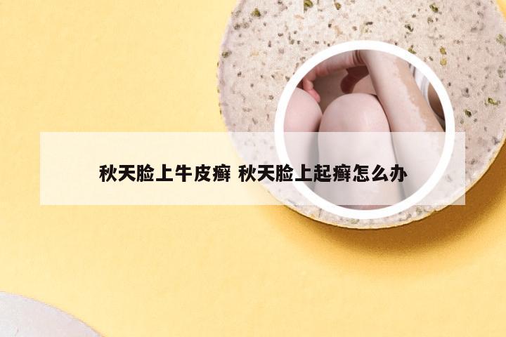 秋天脸上牛皮癣 秋天脸上起癣怎么办