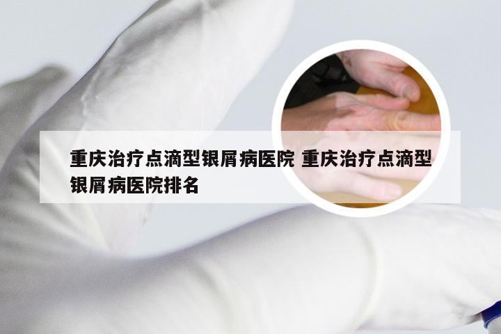 重庆治疗点滴型银屑病医院 重庆治疗点滴型银屑病医院排名