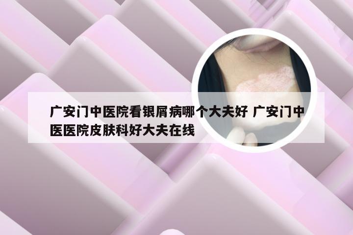 广安门中医院看银屑病哪个大夫好 广安门中医医院皮肤科好大夫在线
