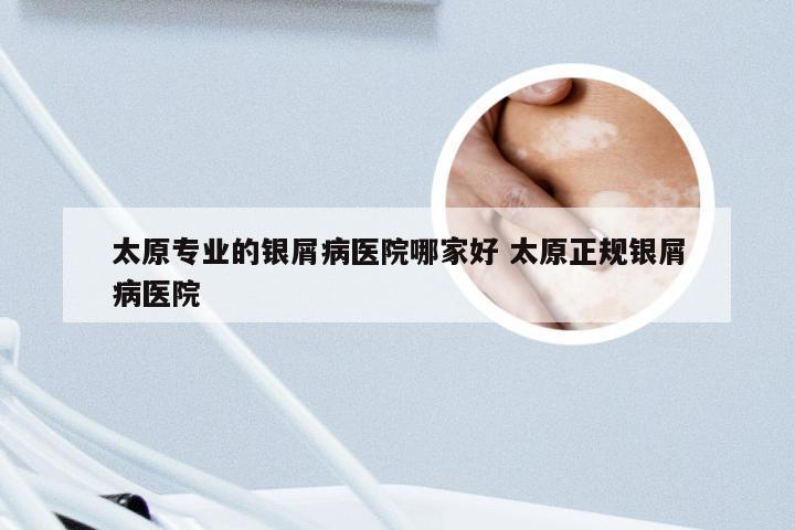 太原专业的银屑病医院哪家好 太原正规银屑病医院
