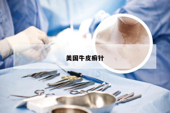 美国牛皮癣针