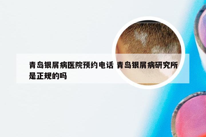 青岛银屑病医院预约电话 青岛银屑病研究所是正规的吗