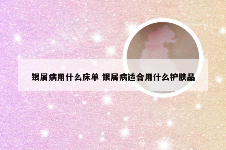 银屑病用什么床单 银屑病适合用什么护肤品