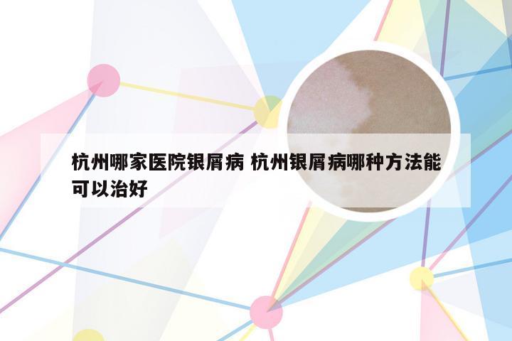 杭州哪家医院银屑病 杭州银屑病哪种方法能可以治好