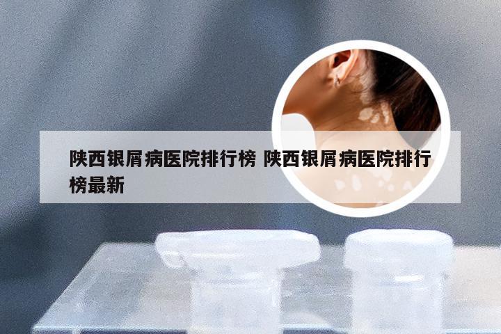 陕西银屑病医院排行榜 陕西银屑病医院排行榜最新