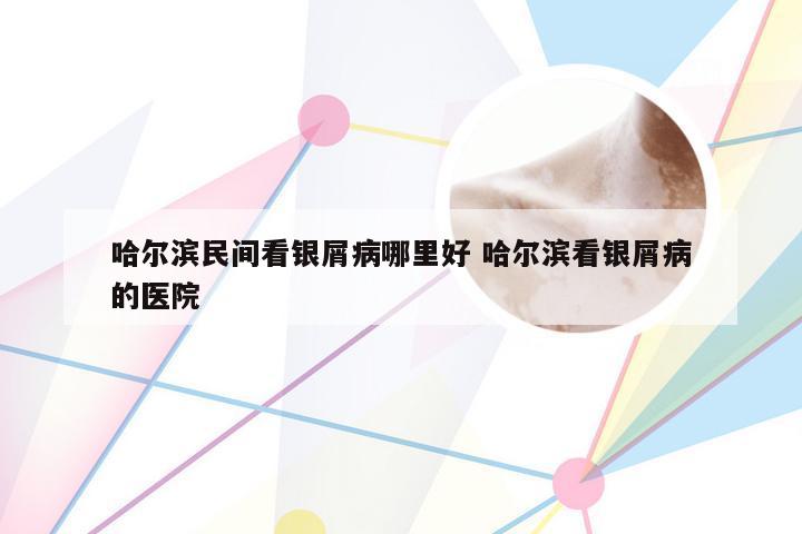 哈尔滨民间看银屑病哪里好 哈尔滨看银屑病的医院