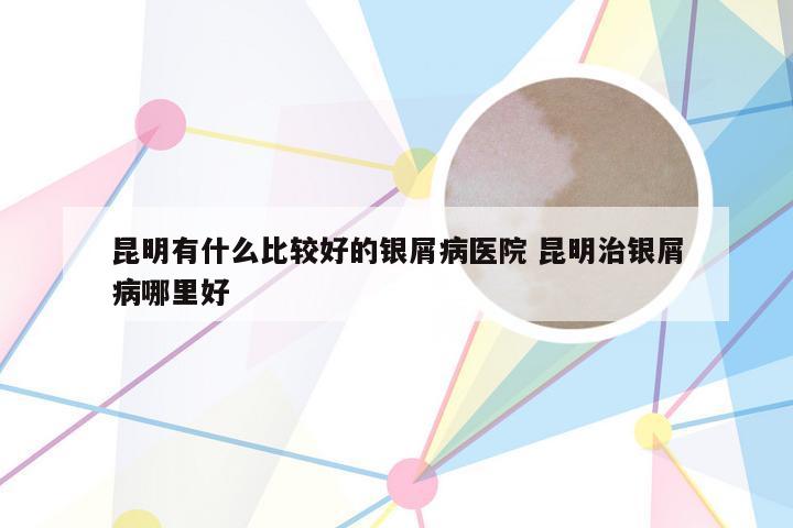 昆明有什么比较好的银屑病医院 昆明治银屑病哪里好