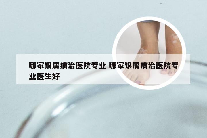 哪家银屑病治医院专业 哪家银屑病治医院专业医生好