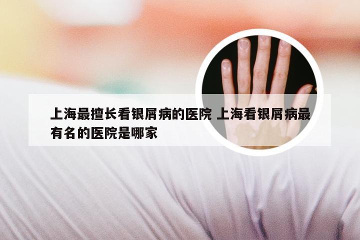 上海最擅长看银屑病的医院 上海看银屑病最有名的医院是哪家