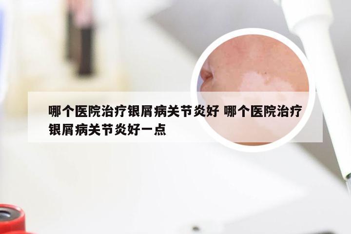 哪个医院治疗银屑病关节炎好 哪个医院治疗银屑病关节炎好一点