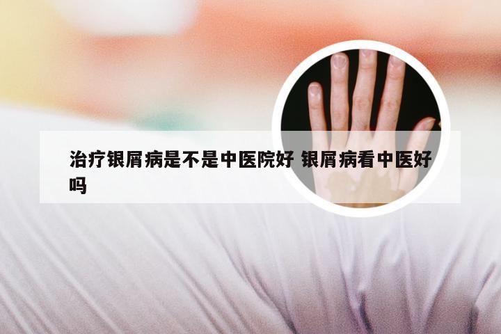 治疗银屑病是不是中医院好 银屑病看中医好吗