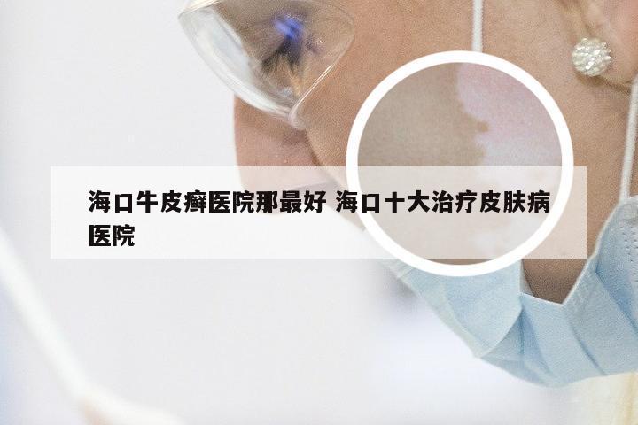 海口牛皮癣医院那最好 海口十大治疗皮肤病医院