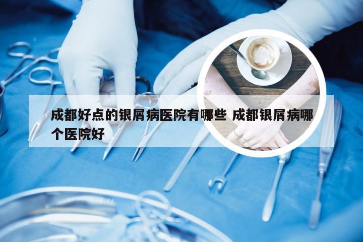成都好点的银屑病医院有哪些 成都银屑病哪个医院好