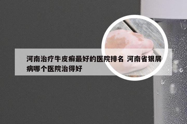河南治疗牛皮癣最好的医院排名 河南省银屑病哪个医院治得好