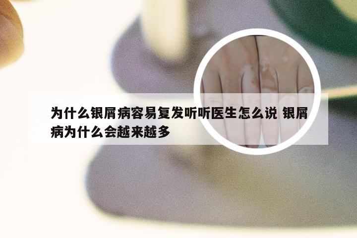 为什么银屑病容易复发听听医生怎么说 银屑病为什么会越来越多