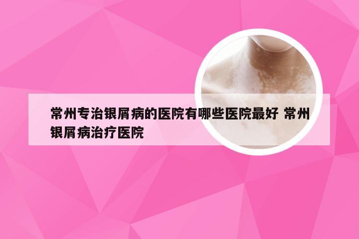 常州专治银屑病的医院有哪些医院最好 常州银屑病治疗医院