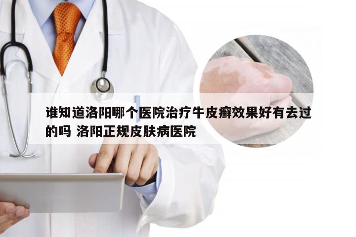 谁知道洛阳哪个医院治疗牛皮癣效果好有去过的吗 洛阳正规皮肤病医院