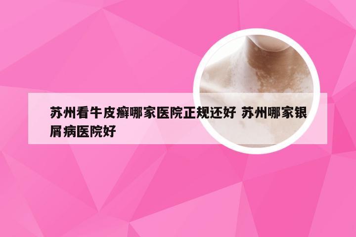 苏州看牛皮癣哪家医院正规还好 苏州哪家银屑病医院好