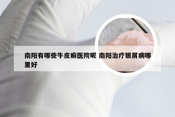 南阳有哪些牛皮癣医院呢 南阳治疗银屑病哪里好