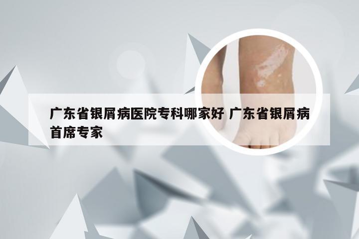 广东省银屑病医院专科哪家好 广东省银屑病首席专家