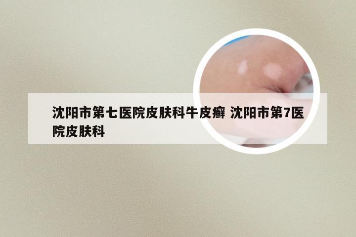 沈阳市第七医院皮肤科牛皮癣 沈阳市第7医院皮肤科