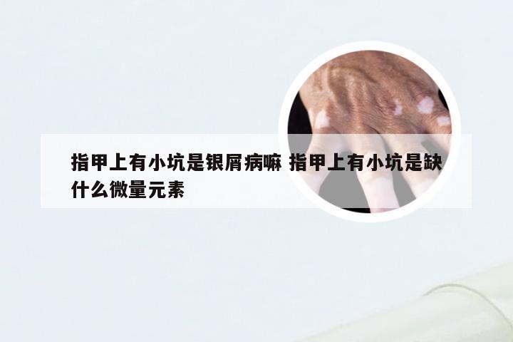 指甲上有小坑是银屑病嘛 指甲上有小坑是缺什么微量元素