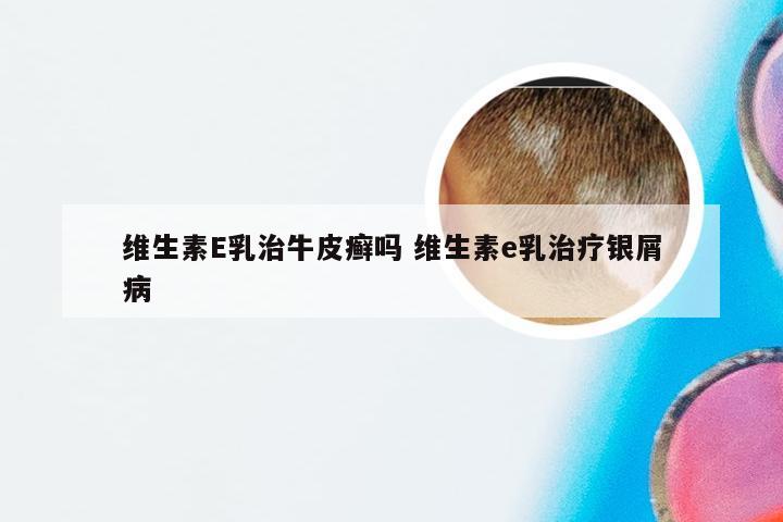 维生素E乳治牛皮癣吗 维生素e乳治疗银屑病