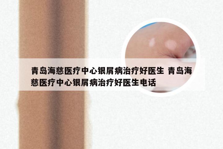 青岛海慈医疗中心银屑病治疗好医生 青岛海慈医疗中心银屑病治疗好医生电话