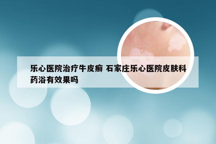 乐心医院治疗牛皮癣 石家庄乐心医院皮肤科药浴有效果吗