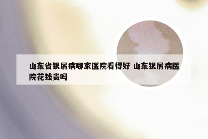 山东省银屑病哪家医院看得好 山东银屑病医院花钱贵吗