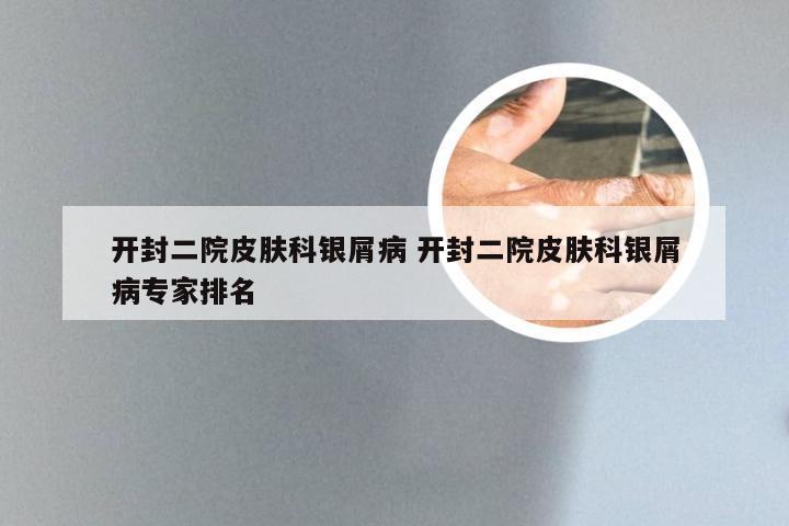 开封二院皮肤科银屑病 开封二院皮肤科银屑病专家排名