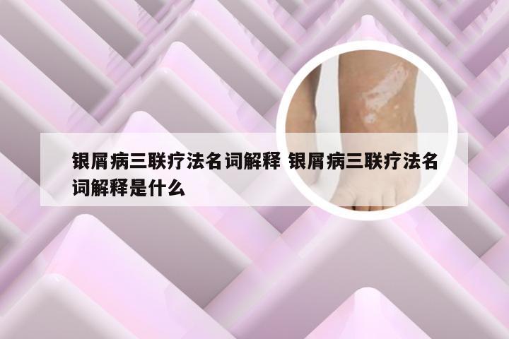 银屑病三联疗法名词解释 银屑病三联疗法名词解释是什么