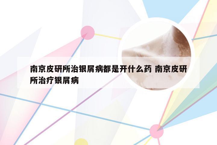 南京皮研所治银屑病都是开什么药 南京皮研所治疗银屑病