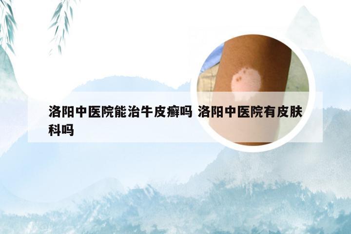 洛阳中医院能治牛皮癣吗 洛阳中医院有皮肤科吗