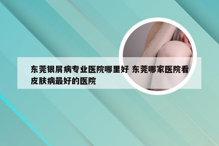 东莞银屑病专业医院哪里好 东莞哪家医院看皮肤病最好的医院