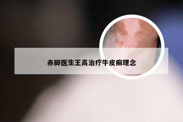 赤脚医生王高治疗牛皮癣理念