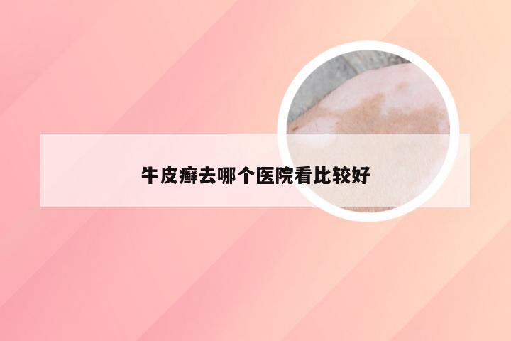 牛皮癣去哪个医院看比较好