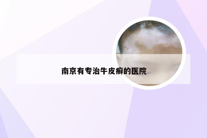南京有专治牛皮癣的医院
