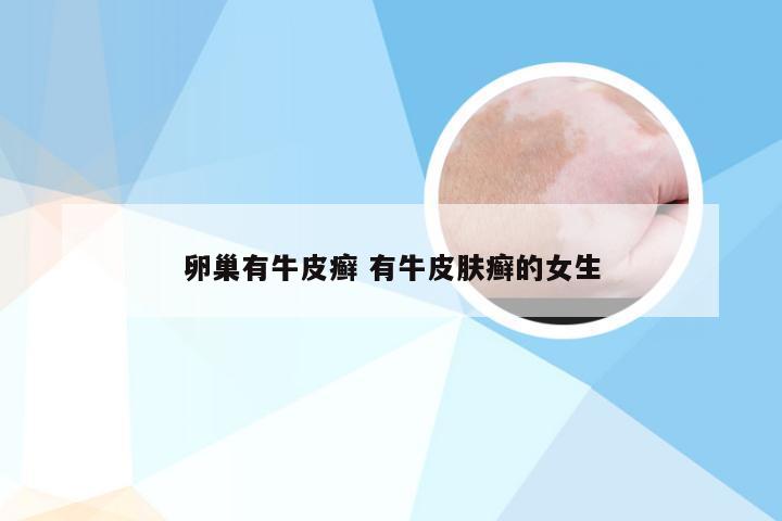 卵巢有牛皮癣 有牛皮肤癣的女生