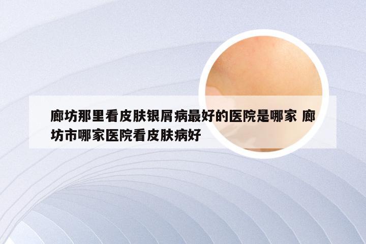 廊坊那里看皮肤银屑病最好的医院是哪家 廊坊市哪家医院看皮肤病好