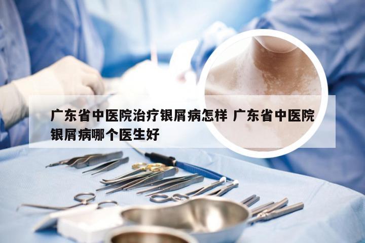 广东省中医院治疗银屑病怎样 广东省中医院银屑病哪个医生好