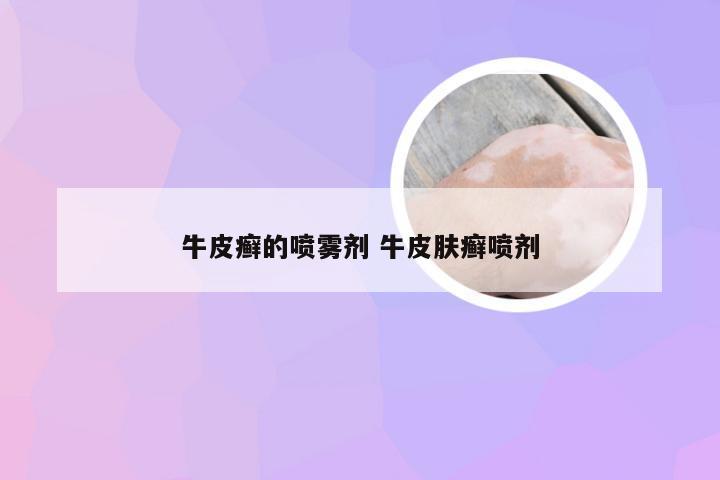 牛皮癣的喷雾剂 牛皮肤癣喷剂