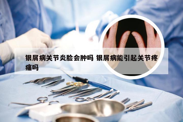 银屑病关节炎脸会肿吗 银屑病能引起关节疼痛吗