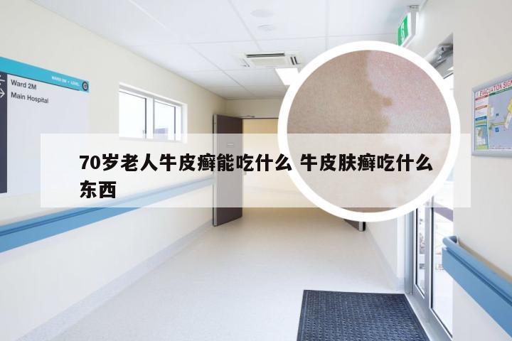 70岁老人牛皮癣能吃什么 牛皮肤癣吃什么东西