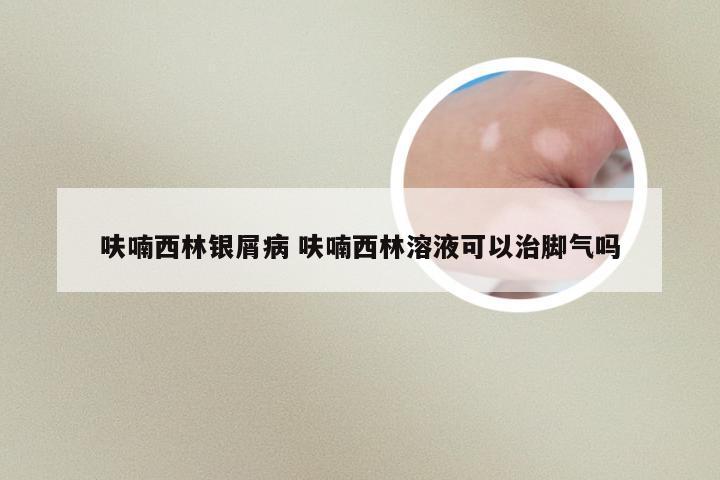 呋喃西林银屑病 呋喃西林溶液可以治脚气吗