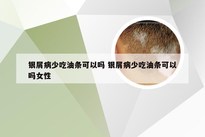 银屑病少吃油条可以吗 银屑病少吃油条可以吗女性